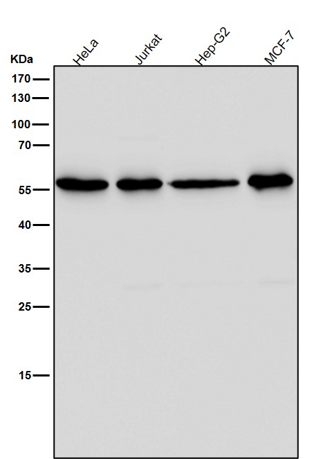 1 - Anti-ACM2 Rabbit Monoclonal Antibody ABO15814