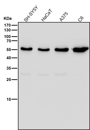 1 - Anti-ACM2 Rabbit Monoclonal Antibody ABO15814
