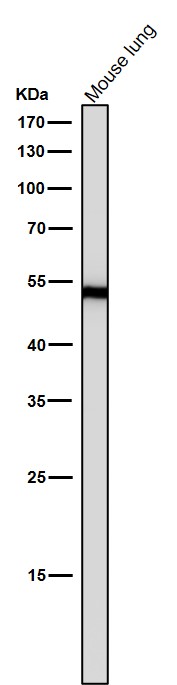 1 - Anti-ACM2 Rabbit Monoclonal Antibody ABO15814
