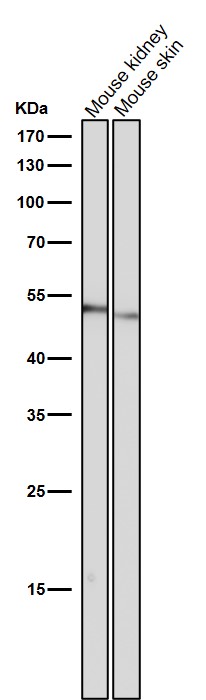 1 - Anti-ACM2 Rabbit Monoclonal Antibody ABO15814