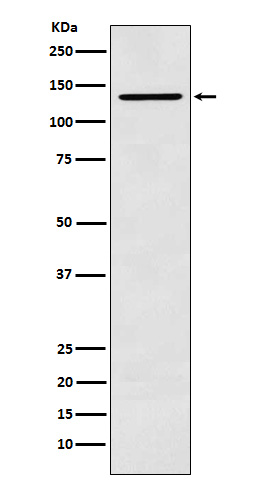 1 - Anti-CARD11 Rabbit Monoclonal Antibody ABO15816