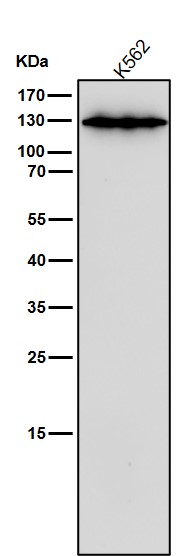 1 - Anti-CARD11 Rabbit Monoclonal Antibody ABO15816