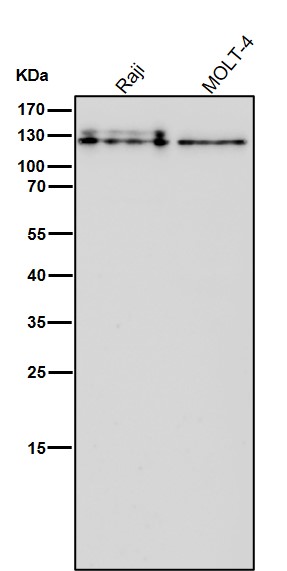 1 - Anti-CARD11 Rabbit Monoclonal Antibody ABO15816