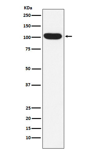 1 - Anti-ITCH Rabbit Monoclonal Antibody ABO15820