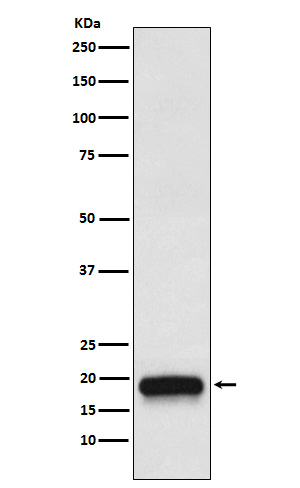 1 - Anti-VEGFB Rabbit Monoclonal Antibody ABO15822
