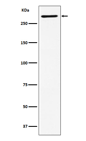 1 - Anti-EDD Rabbit Monoclonal Antibody ABO15823