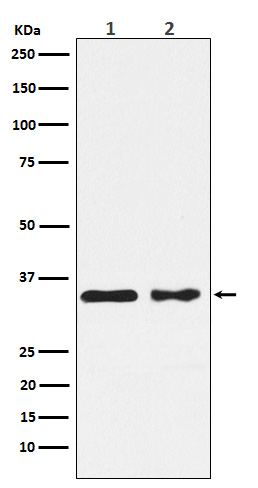 1 - Anti-CSNK1A1 Rabbit Monoclonal Antibody ABO15825
