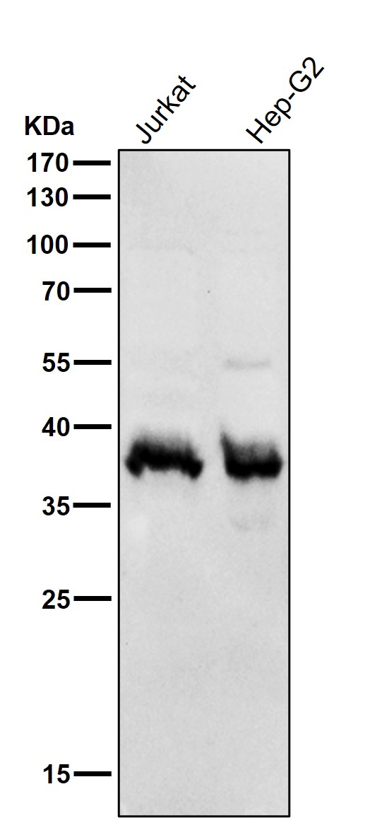 1 - Anti-CSNK1A1 Rabbit Monoclonal Antibody ABO15825