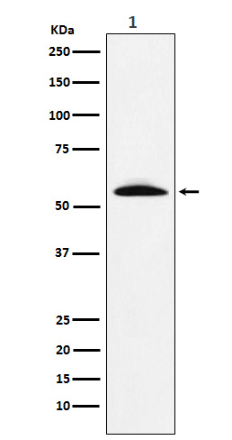 1 - Anti-GGT1 Rabbit Monoclonal Antibody ABO15827