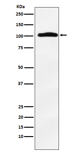 1 - Anti-Thyroid Peroxidase Rabbit Monoclonal Antibody ABO15828