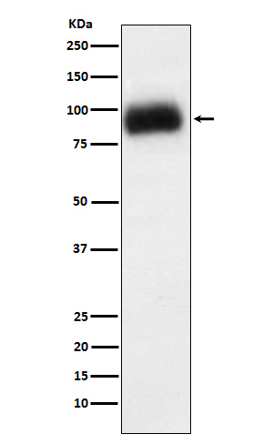 1 - Anti-ADAM15 Rabbit Monoclonal Antibody ABO15835
