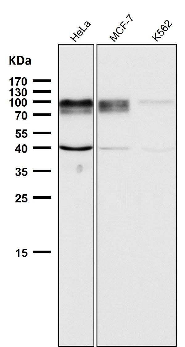 1 - Anti-ADAM15 Rabbit Monoclonal Antibody ABO15835