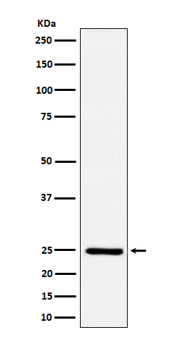 1 - Anti-Ephrin A1 Rabbit Monoclonal Antibody ABO15837
