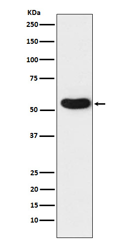 1 - Anti-CHRNA5 Rabbit Monoclonal Antibody ABO15839