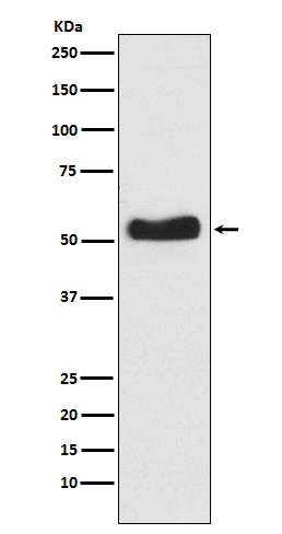 1 - Anti-Glucokinase Rabbit Monoclonal Antibody ABO15841