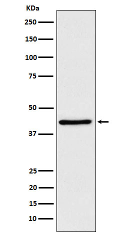1 - Anti-WIF1 Rabbit Monoclonal Antibody ABO15842