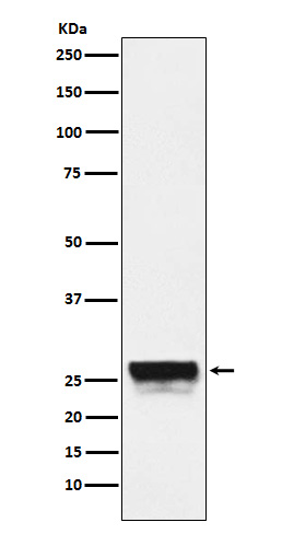 1 - Anti-CTRL Rabbit Monoclonal Antibody ABO15843