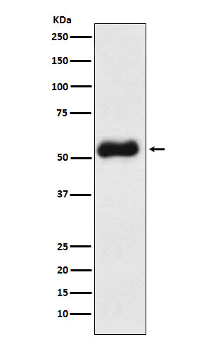 1 - Anti-Thromboxane synthase Rabbit Monoclonal Antibody ABO15844