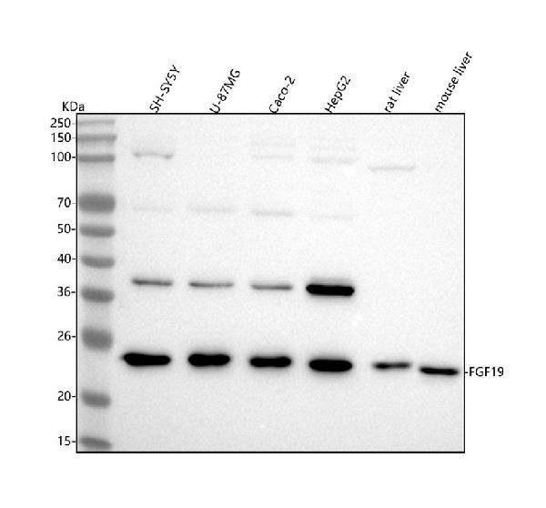 1 - Anti-FGF19 Rabbit Monoclonal Antibody ABO15845