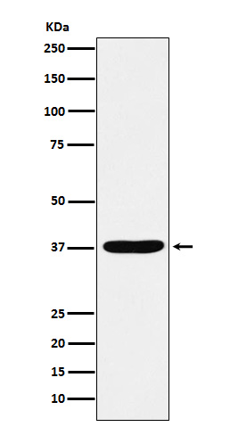 1 - Anti-AKR1C1 / AKR1C2 Rabbit Monoclonal Antibody ABO15846