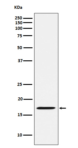 1 - Anti-FHIT Rabbit Monoclonal Antibody ABO15847