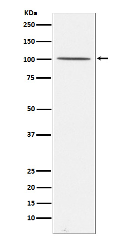 1 - Anti-Gemin 3 Rabbit Monoclonal Antibody ABO15848