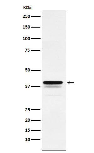 1 - Anti-FOXF1 Rabbit Monoclonal Antibody ABO15850