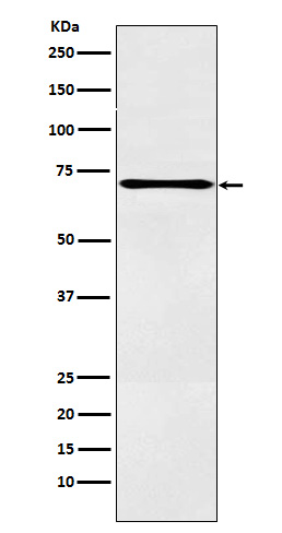 1 - Anti-LOX12 Rabbit Monoclonal Antibody ABO15852