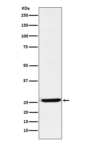 1 - Anti-EBI3 Rabbit Monoclonal Antibody ABO15857