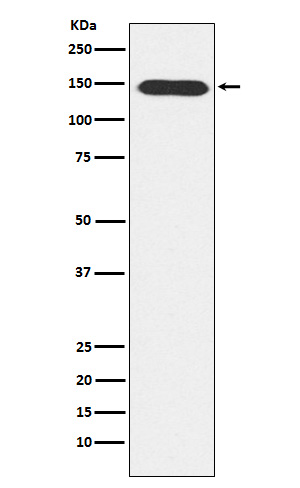 1 - Anti-PLCB3 Rabbit Monoclonal Antibody ABO15858