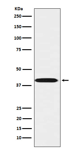 1 - Anti-LHX3 Rabbit Monoclonal Antibody ABO15859