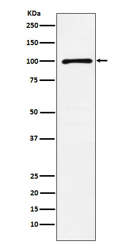 1 - Anti-GRIK2 Rabbit Monoclonal Antibody ABO15862