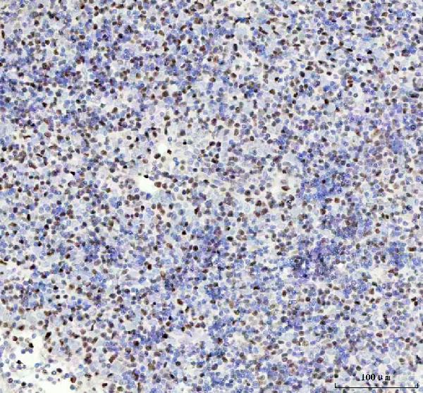 2 - Anti-MCM4 Rabbit Monoclonal Antibody ABO15863