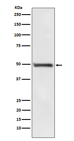 1 - Anti-RAD52 Rabbit Monoclonal Antibody ABO15866