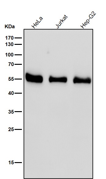 1 - Anti-RAD52 Rabbit Monoclonal Antibody ABO15866