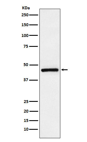 1 - Anti-TMEFF2 Rabbit Monoclonal Antibody ABO15868