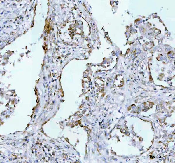 2 - Anti-IMP2 Rabbit Monoclonal Antibody ABO15869