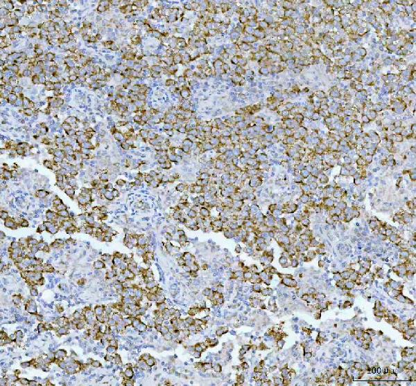 2 - Anti-IMP2 Rabbit Monoclonal Antibody ABO15869