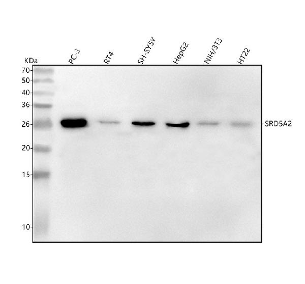 1 - Anti-SRD5A2 Rabbit Monoclonal Antibody ABO15870