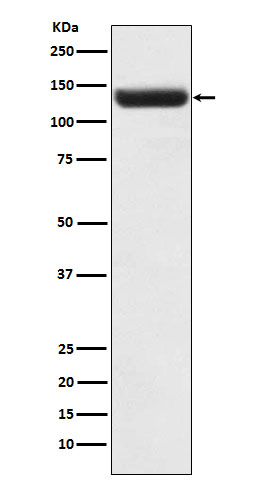 1 - Anti-ZNF217 Rabbit Monoclonal Antibody ABO15871