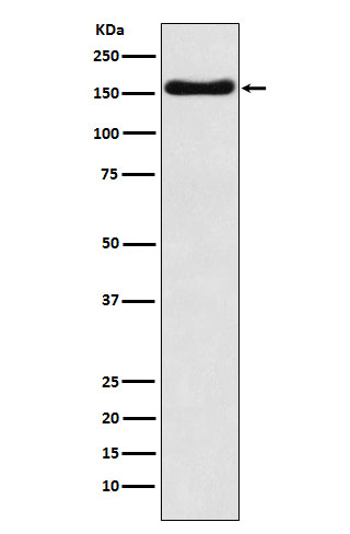 1 - Anti-ATP7b Rabbit Monoclonal Antibody ABO15873