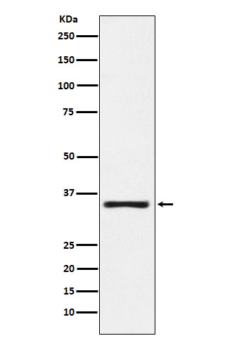 1 - Anti-KLK2 Rabbit Monoclonal Antibody ABO15875