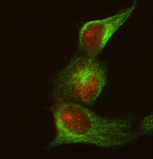 3 - Anti-CRKII Rabbit Monoclonal Antibody ABO15876