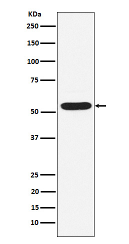 1 - Anti-PIAS2 Rabbit Monoclonal Antibody ABO15877
