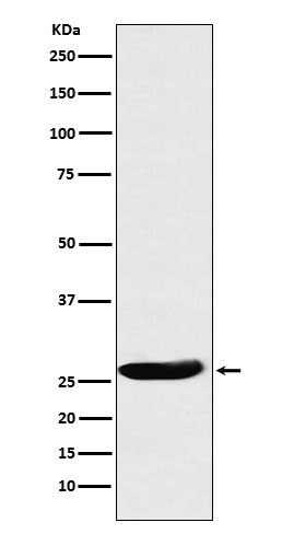 1 - Anti-CLPP Rabbit Monoclonal Antibody ABO15878