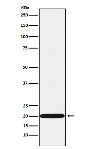 1 - Anti-UBE2C Rabbit Monoclonal Antibody ABO15881