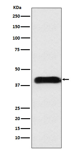 1 - Anti-M6PR Rabbit Monoclonal Antibody ABO15882