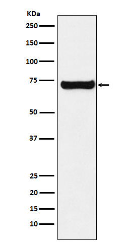 1 - Anti-SESN1 Rabbit Monoclonal Antibody ABO15883