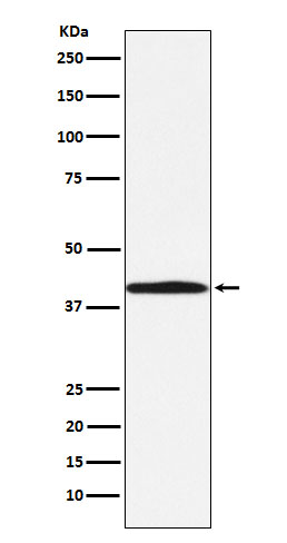 1 - Anti-BGAT Rabbit Monoclonal Antibody ABO15884