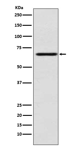 1 - Anti-MADCAM1 Rabbit Monoclonal Antibody ABO15886